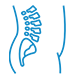Ankylosing spondylitis