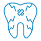 Cracked Teeth