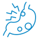 Gastroesophageal Reflux Disease