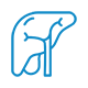 Transhepatic Pancreato-Cholangiography (TPC)