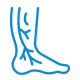 Varicose veins