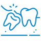 Wisdom Tooth Removal,